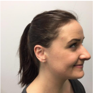 TMJ case study