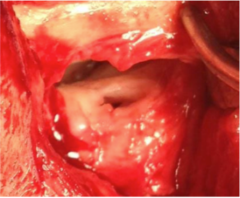 TMJ case study