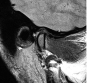 TMJ case study