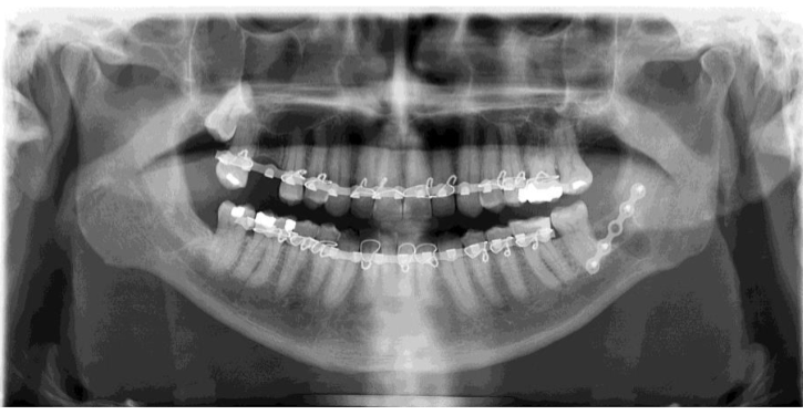 Facial trauma case study