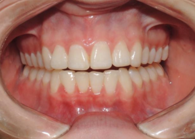 TMJ case study