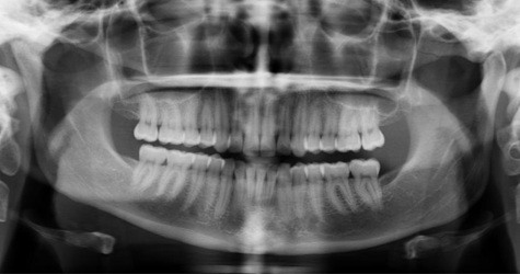TMJ case study