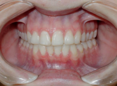 TMJ case study