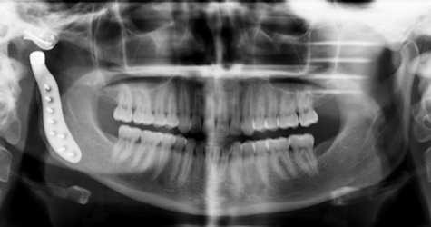 TMJ case study