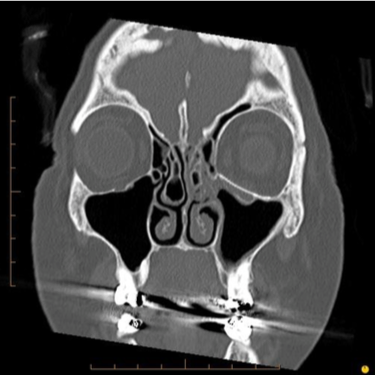 Facial trauma case study