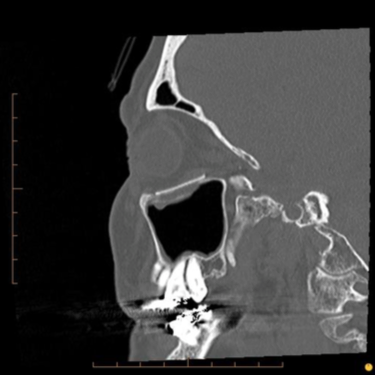 Facial trauma case study