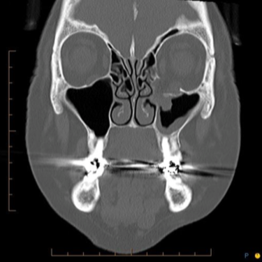 Facial trauma case study
