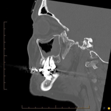 Facial trauma case study