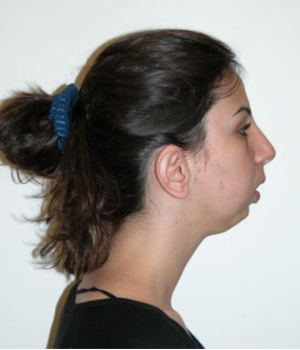 TMJ case study