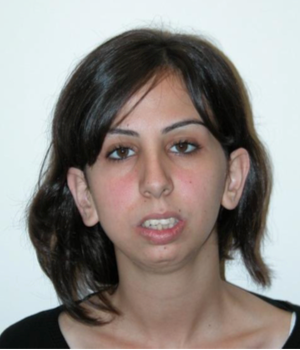 TMJ case study