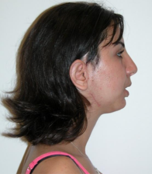 TMJ case study