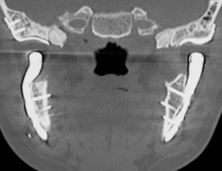 TMJ case study