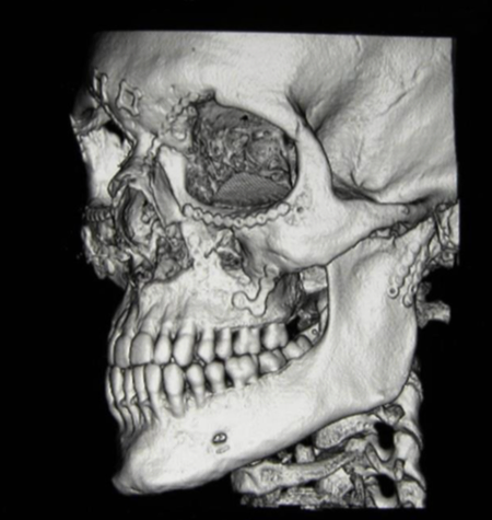Facial trauma case study