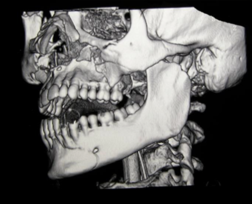 Facial trauma case study